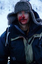 bear-grylls-bloody.jpg